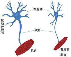 运动神经元病简介