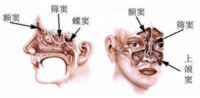 又是发生变态反应疾病的部位,所以花粉症和变应性鼻炎是常见病;某些