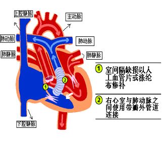 主