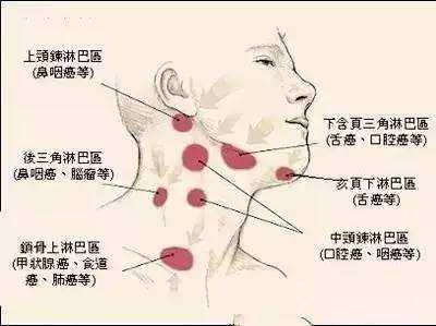 急性淋巴结炎