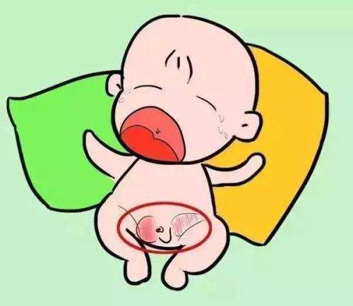 新生儿阴囊积液图片图片
