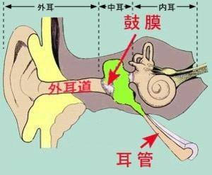 大疱性鼓膜炎