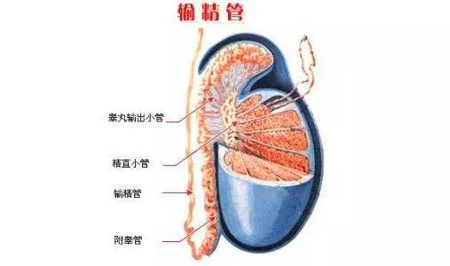 输精管堵塞怎么治图片